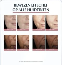 Eucerin Anti-Pigment Spotcorrector - Concealer - 5 Ml 16 Eucerin Anti-Pigment Spotcorrector - Concealer - 5 Ml -Max Factor Winkel 1157x1200