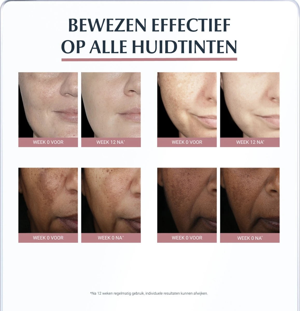 Eucerin Anti-Pigment Spotcorrector - Concealer - 5 Ml 8 Eucerin Anti-Pigment Spotcorrector - Concealer - 5 Ml - Afbeelding 6