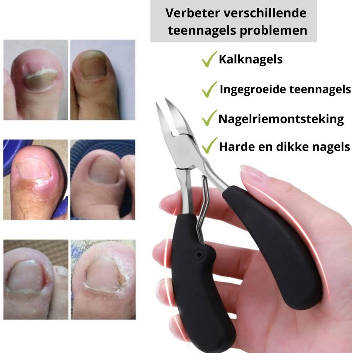 Merkloos Nageltang Voor Harde Teennagels - Manicureset Teennagelknipper - Teennagelschaar - Pedicure Set 5 Merkloos Nageltang Voor Harde Teennagels - Manicureset Teennagelknipper - Teennagelschaar - Pedicure Set - Afbeelding 3