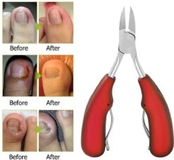 IGOODS Nagelriem Knipper - Professionele Teennagelknipper Cutter Tang - RVS - Zwart - Dikke Nagels Tool Gesneden Nagel - Teen Trimmer -Max Factor Winkel 1200x1106 4
