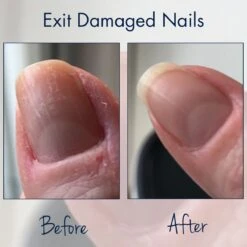 Herome Combi-Pack Exit Damaged Nails & Nagelverharder Extra Sterk (Nail Hardener Extra Strong) - Herstelt Beschadigde Nagels En Zorgt Voor Ijzersterke Nagels - 7ml. & 10ml. 17 Herome Combi-Pack Exit Damaged Nails & Nagelverharder Extra Sterk (Nail Hardener Extra Strong) - Herstelt Beschadigde Nagels En Zorgt Voor Ijzersterke Nagels - 7ml. & 10ml. -Max Factor Winkel 1200x1200 1236