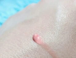 Biodermal Sun Lipbalm SPF25 - Tube 12 Ml - Natural Pink - Lippenbalsem 9 Biodermal Sun Lipbalm SPF25 - Tube 12 Ml - Natural Pink - Lippenbalsem -Max Factor Winkel 1200x927